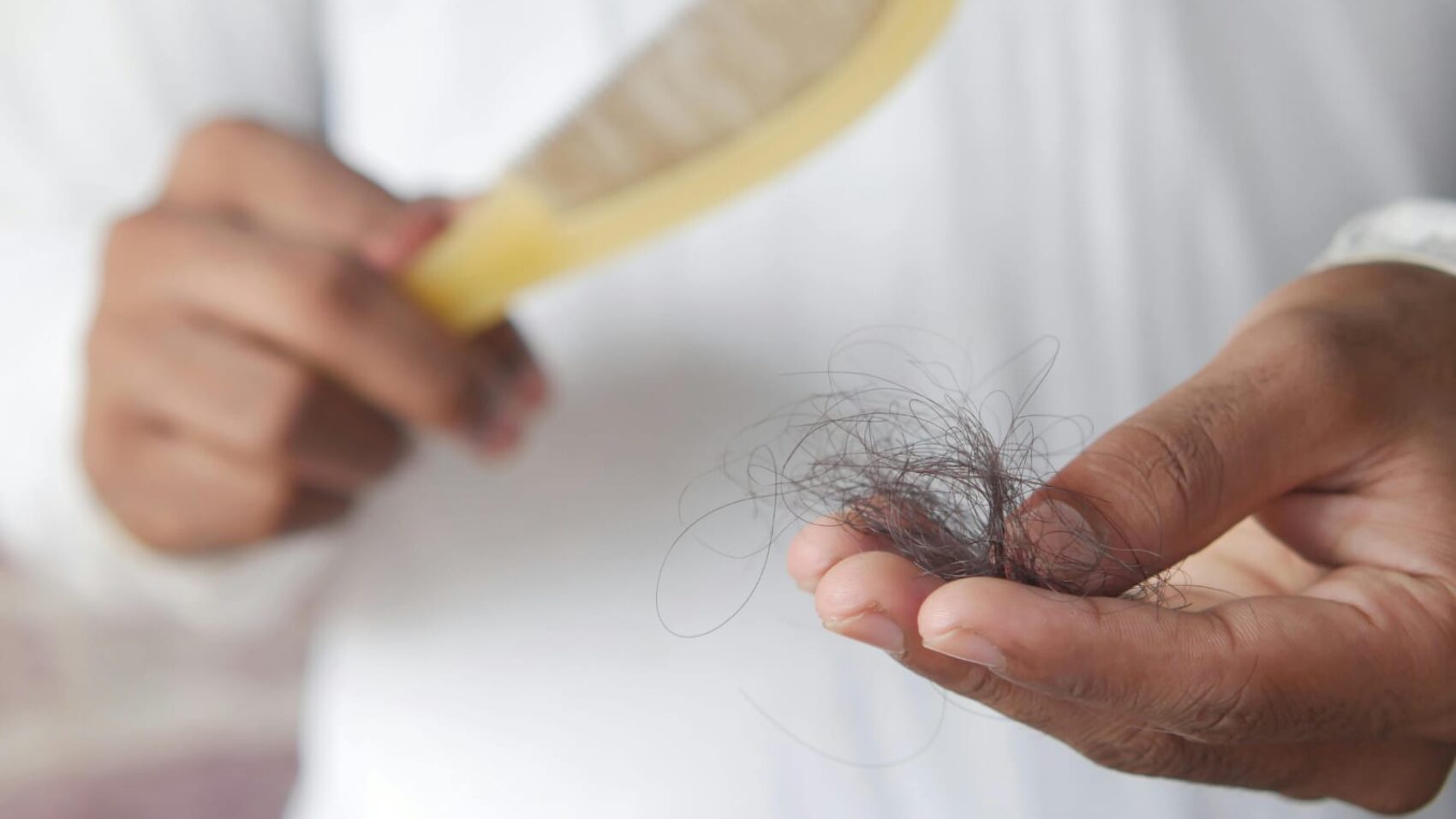 Por que o cabelo cai mais no verão Entenda como identificar as causas